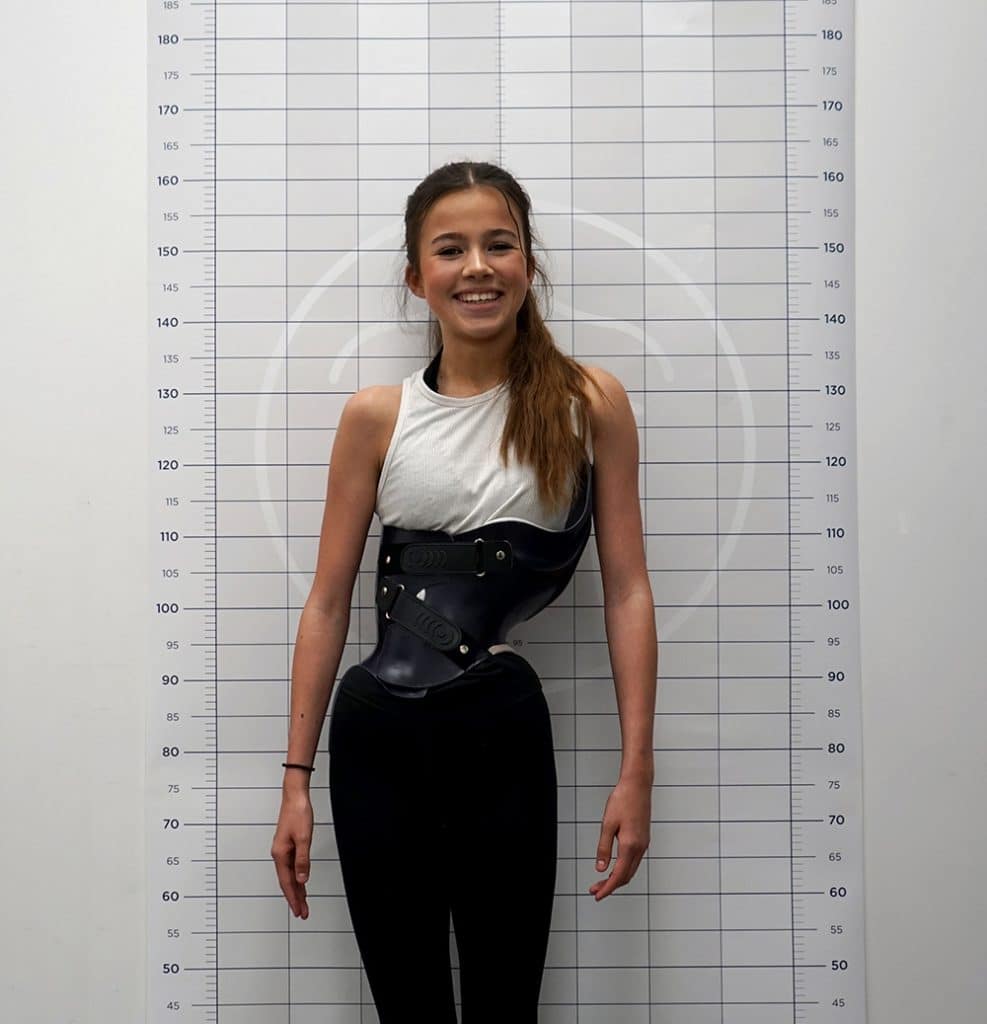 Scoliosis – Early Detection and Treatment