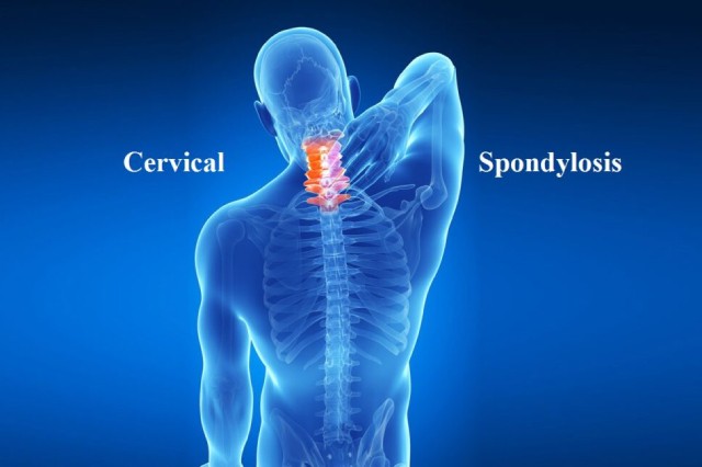 Cervical Spondylosis – Understanding Neck Spine Problems